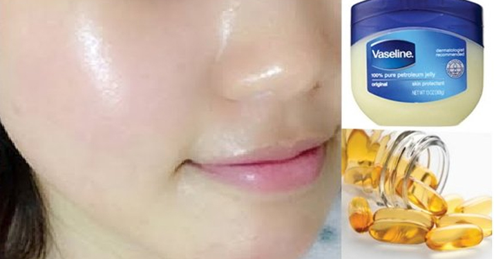Вазелин, витамин e — ночное лечение, чтобы получить чистую безупречную кожу