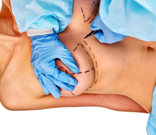 Пластическая хирургия. Уменьшение груди Пластическая хирургия. Уменьшение груди