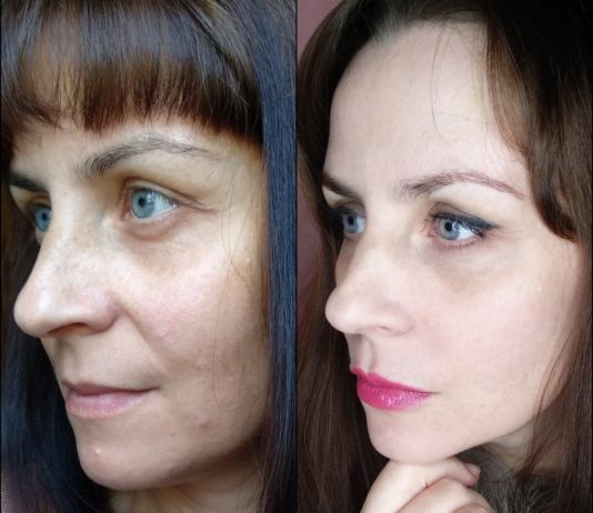 Где можно сделать ботокс в Нижнем Новгороде по доступной цене Где можно сделать ботокс в Нижнем Новгороде по доступной цене