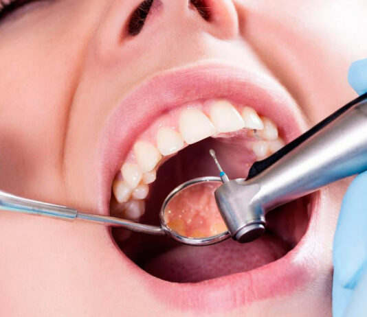 Кариес зубов: что это такое и как его лечить? Кариес зубов: что это такое и как его лечить?