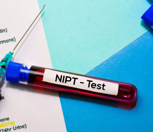 Что такое НИПТ анализ и когда он нужен Что такое НИПТ анализ и когда он нужен