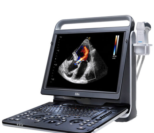 Портативный УЗИ-сканер Chison SonoTouch ST60 по цене официального дилера Портативный УЗИ-сканер Chison SonoTouch ST60 по цене официального дилера