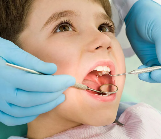 Кариес у детей Кариес у детей