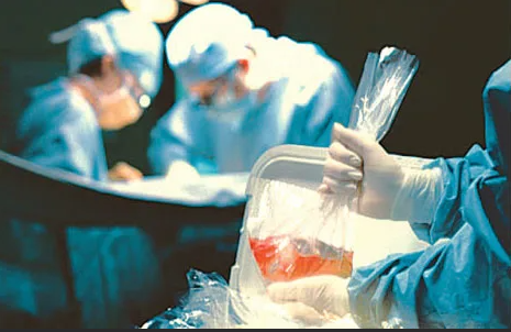 Трансплантология в Турции и Индии: что нужно знать, собираясь на лечение?