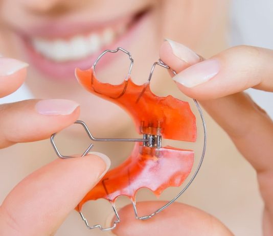 Стоматологические капы — какие они, когда использовать, какова их стоимость? Стоматологические капы - какие они, когда использовать, какова их стоимость?