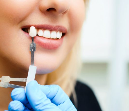 Эстетическая реставрация зубов: что это и особенности