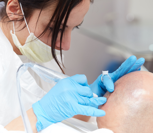 Когда нужно делать трихопигментацию?